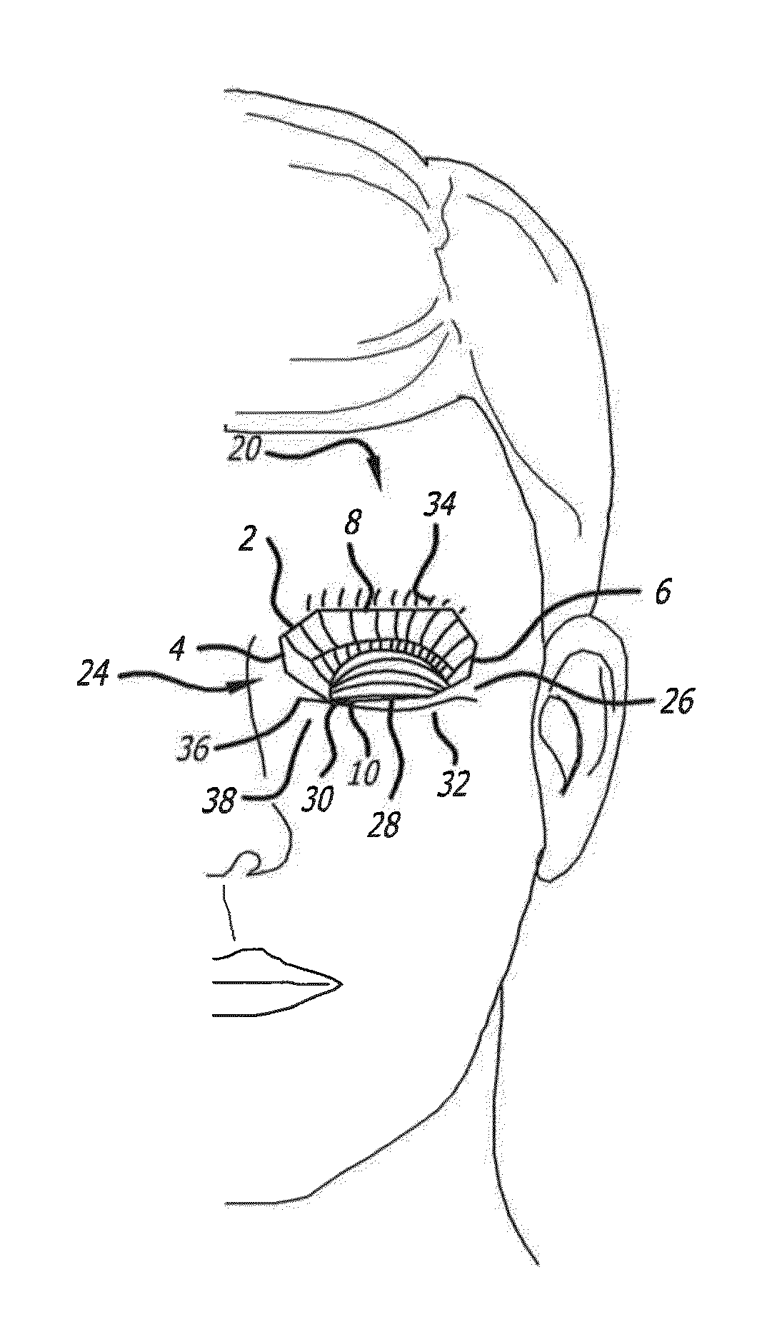 Tarsus Eyelid Patch