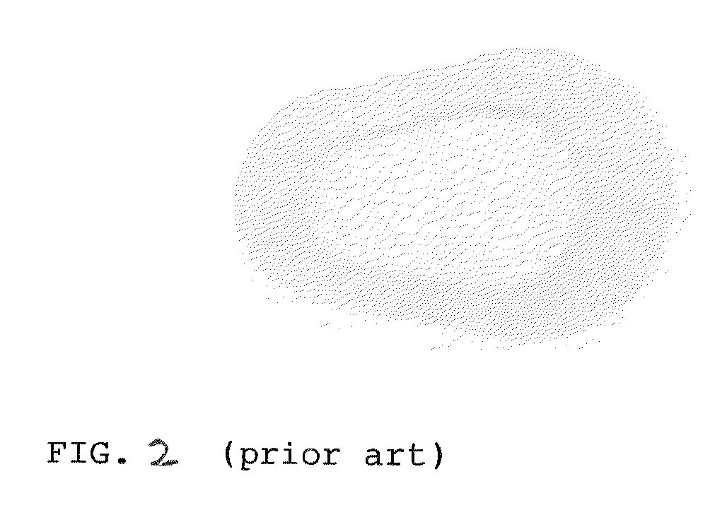 Tarsus Eyelid Patch