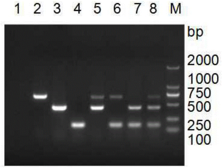 Multi-PCR (Polymerase Chain Reaction) specific primer for detecting bacterial enteritis pathogens of pig and application thereof