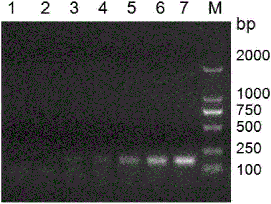 Multi-PCR (Polymerase Chain Reaction) specific primer for detecting bacterial enteritis pathogens of pig and application thereof
