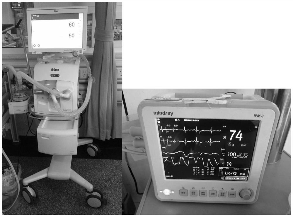 Identification method and system based on integrated tree for false positive alarm signals in ventilator