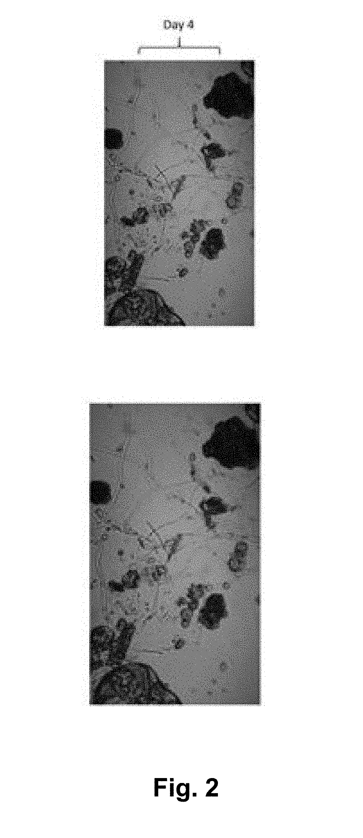 Methods for the Production and Use of Myceliated High Protein Food Compositions