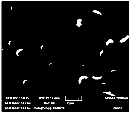 A preparation method of anti-tumor nanoparticle medicine