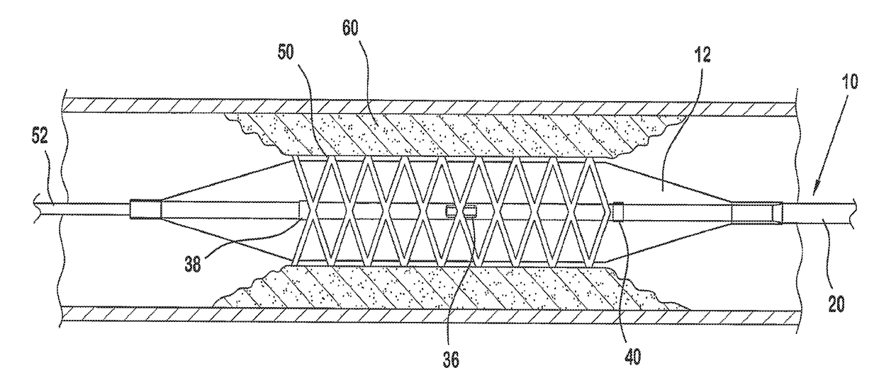 Balloon catheter with centralized vent hole