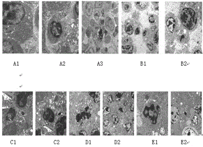 Traditional Chinese medicine composition for treating malignant tumors of upper gastrointestinal tract and preparing method