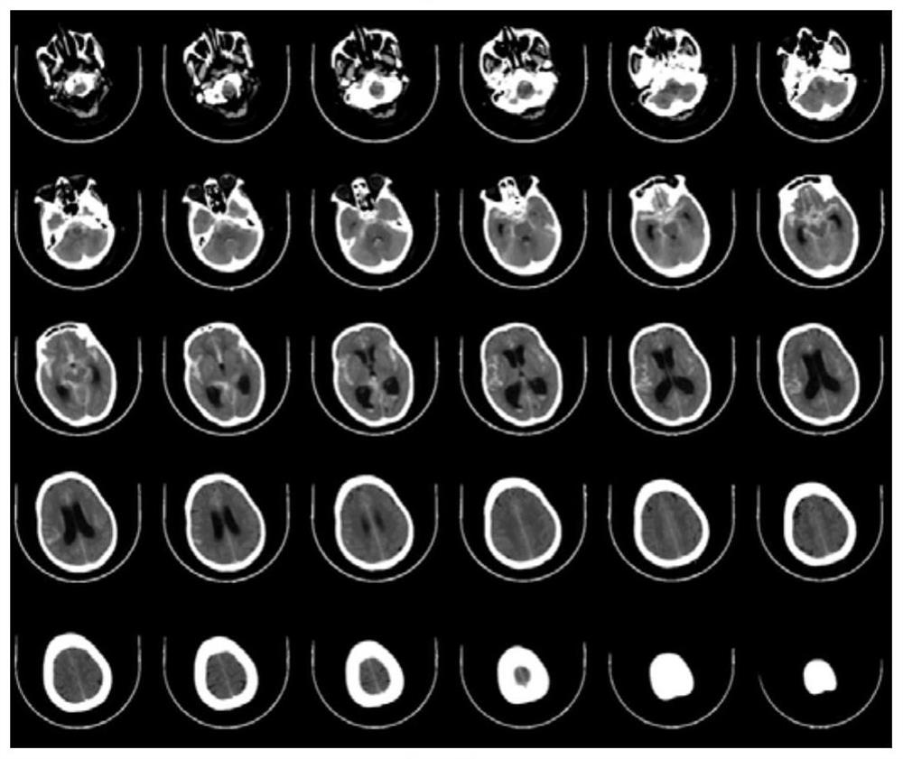 Brain image-based hemorrhagic area determination method and device, equipment and medium