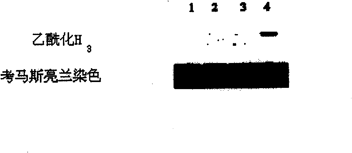 Purpose of a medicine composition in preparing medicament for enhancing effect of radiation therapy and chemotherapy