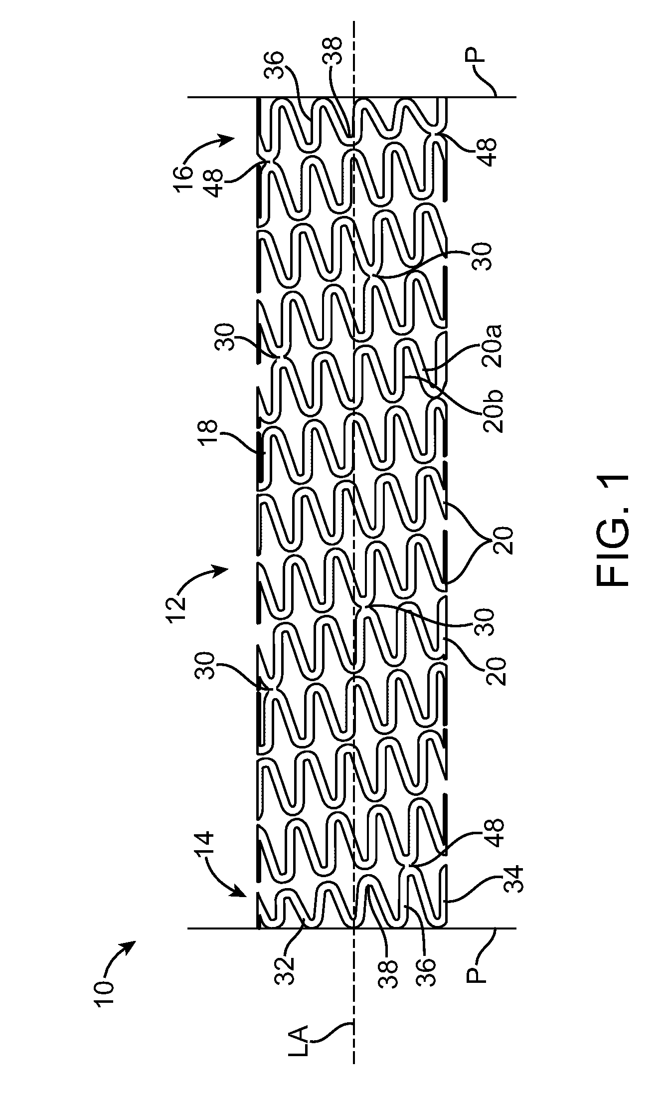 Stent With Improved Mechanical Properties