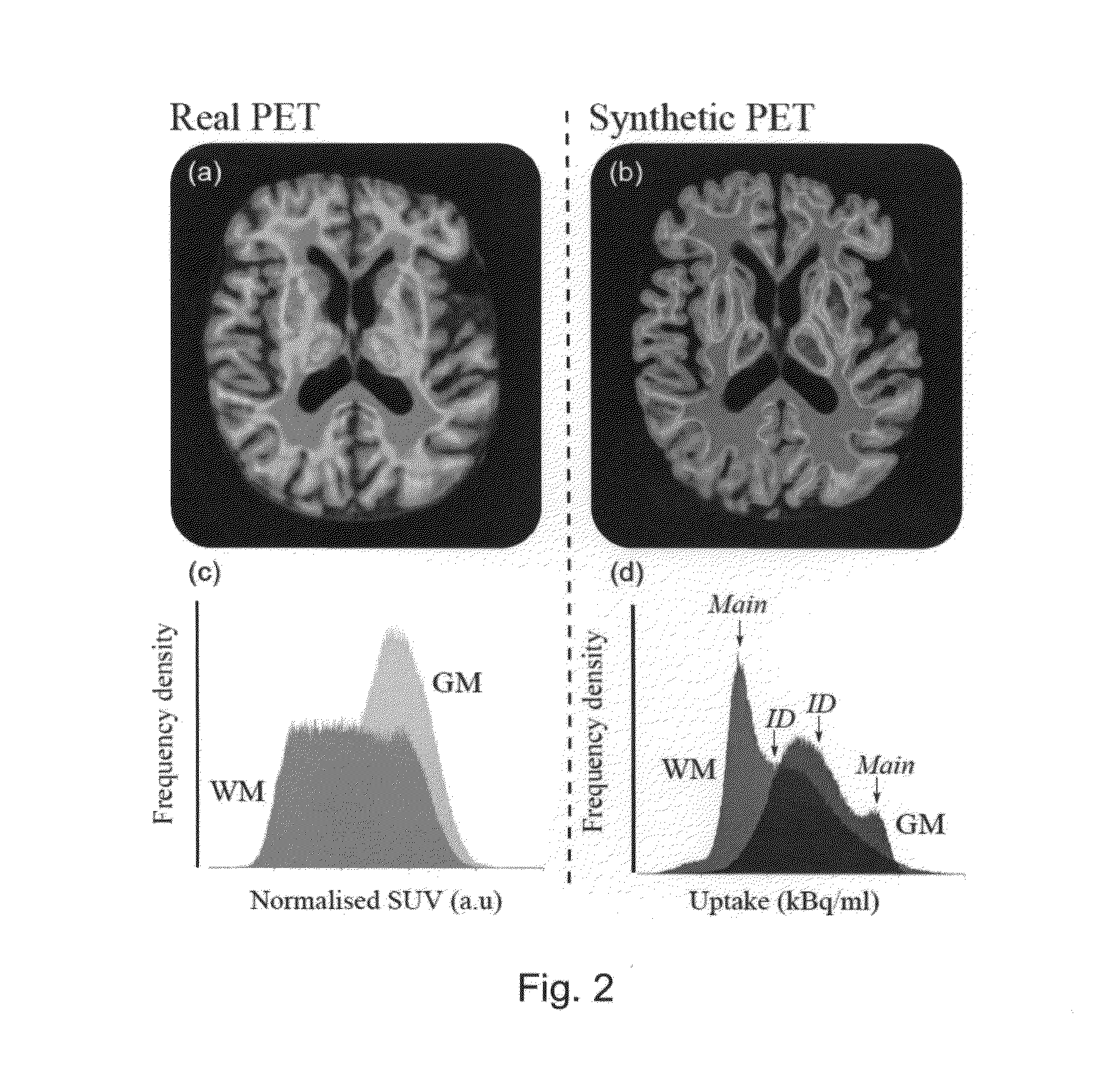 Method for improved estimation of tracer uptake in physiological image volumes