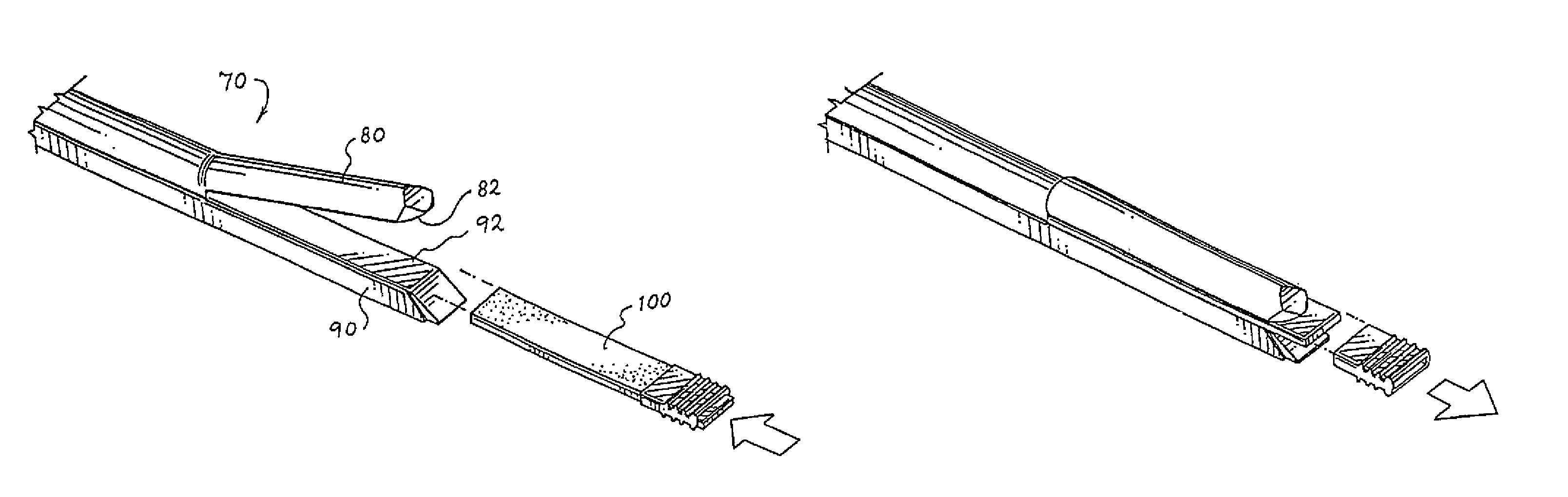 Apparatus and method for producing a reinforced surgical staple line