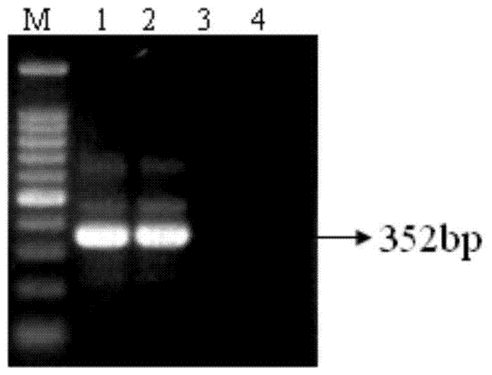 Nested PCR (Polymerase Chain Reaction) detection kit for canna yellow mottle virus and detection method thereof