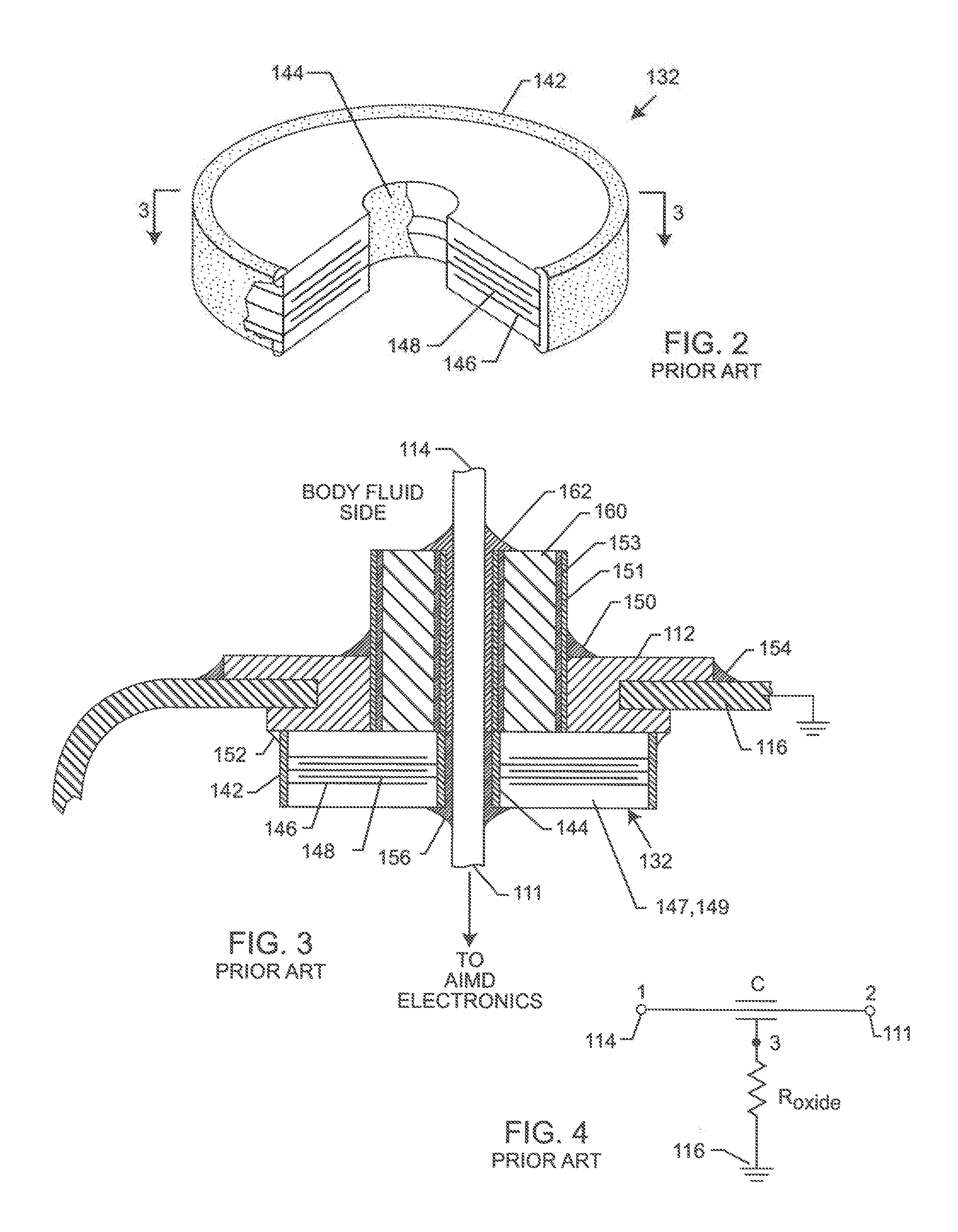 Low impedance oxide resistant grounded capacitor for an aimd