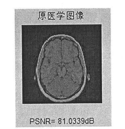 Medical-image robust multiple-watermark method based on DWT (Discrete Wavelet Transform) and DCT (Discrete Cosine Transform)