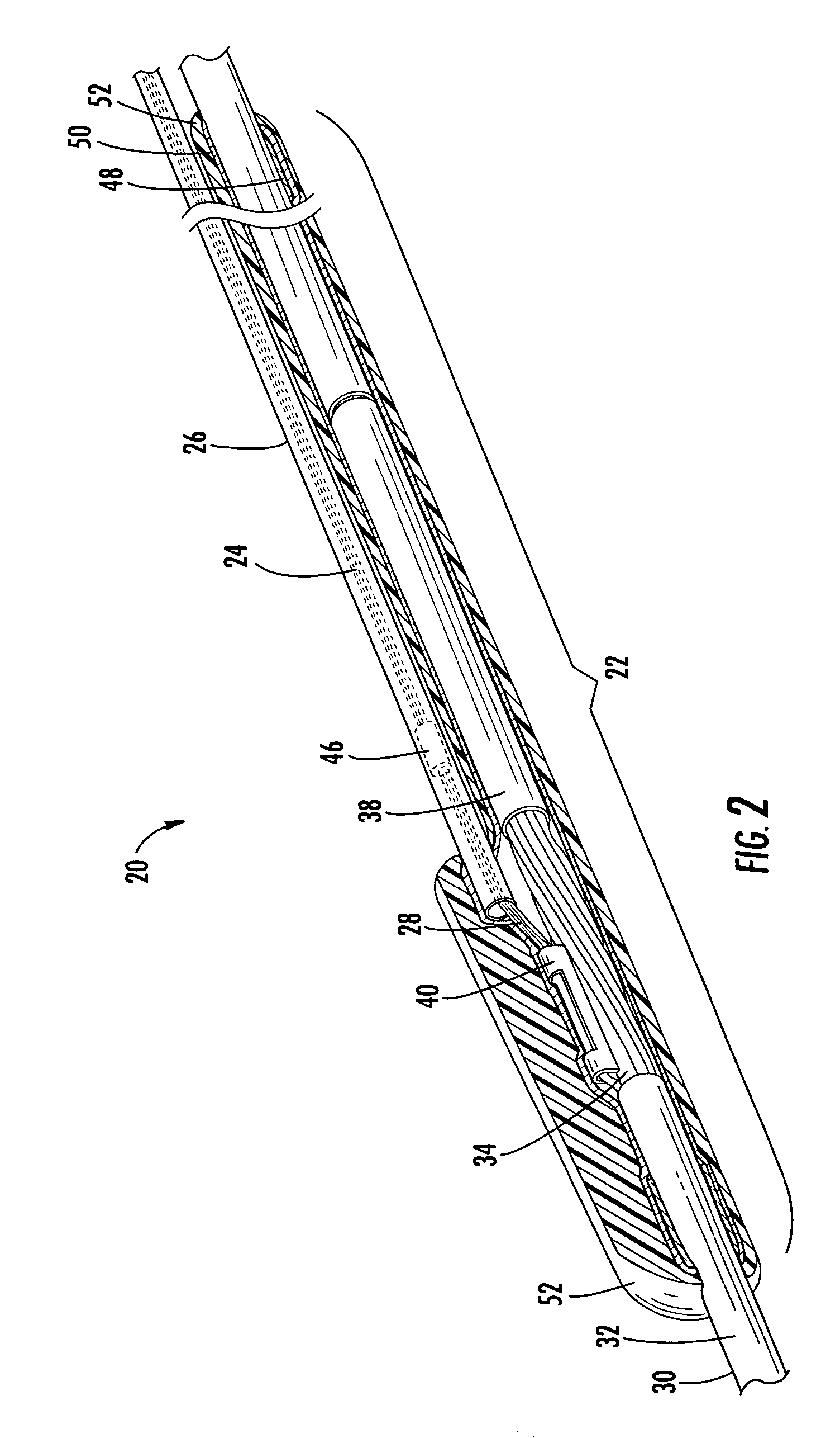 Distribution cable assembly having overmolded mid-span access location