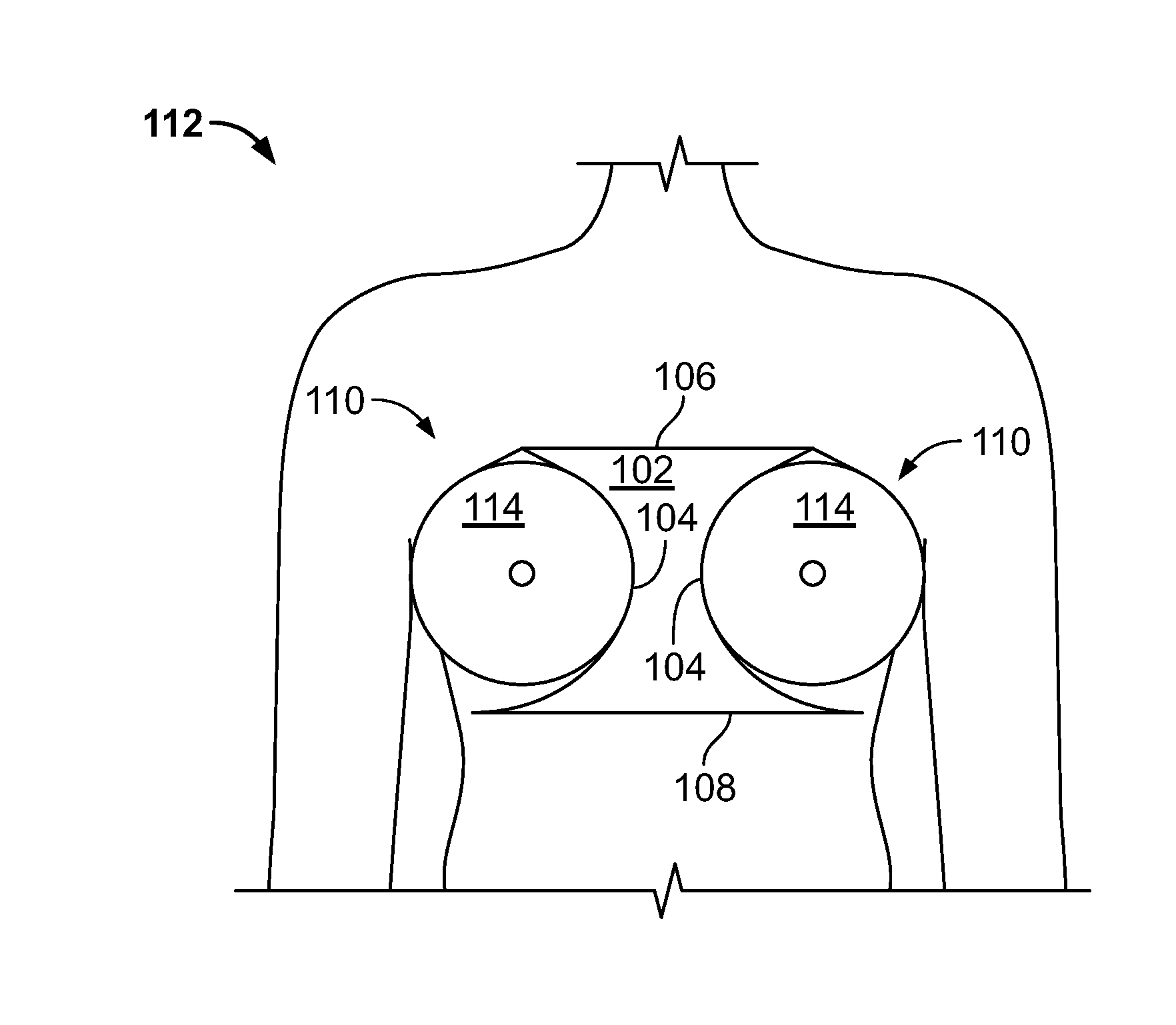 Breast separator and methods thereof