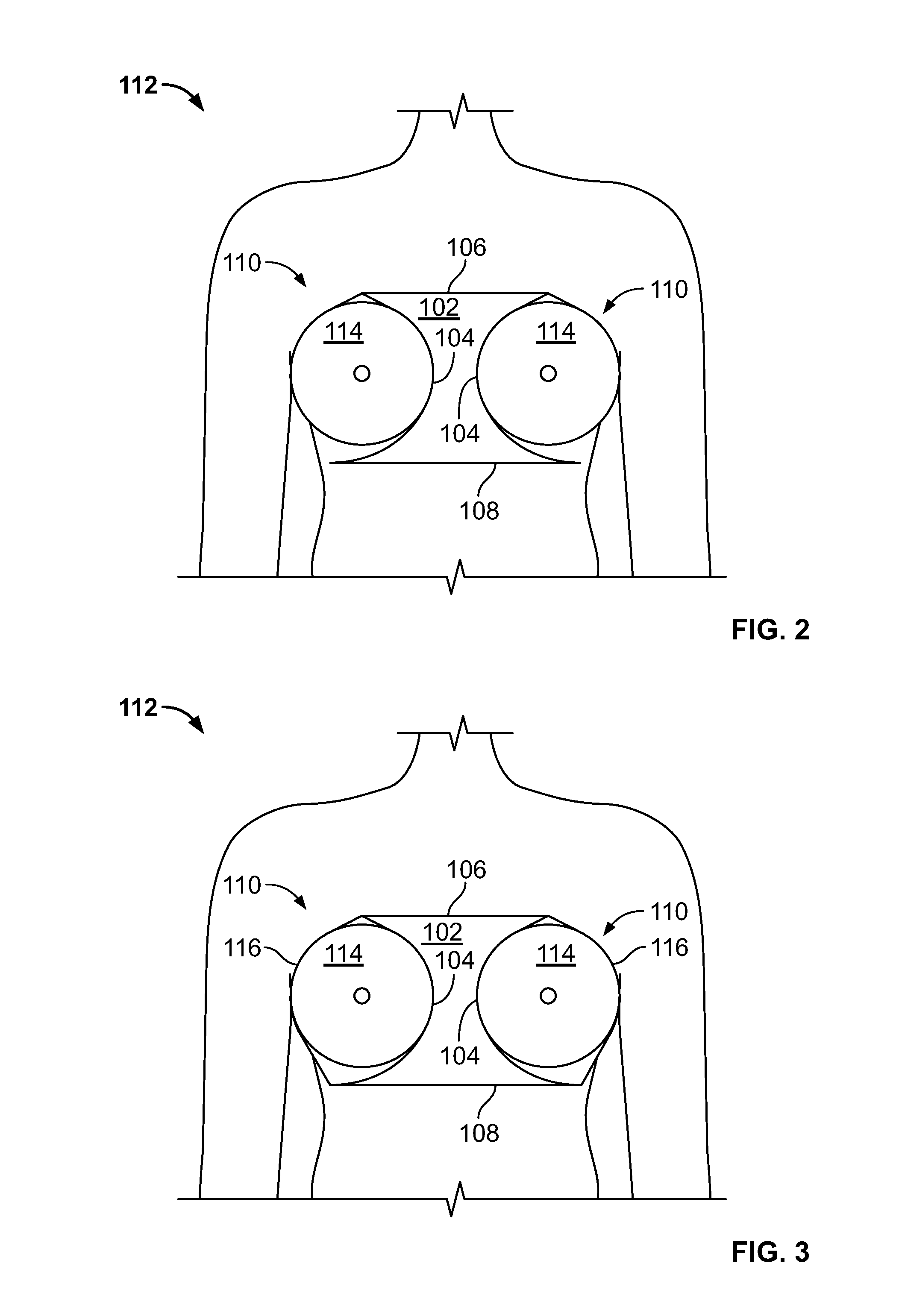 Breast separator and methods thereof