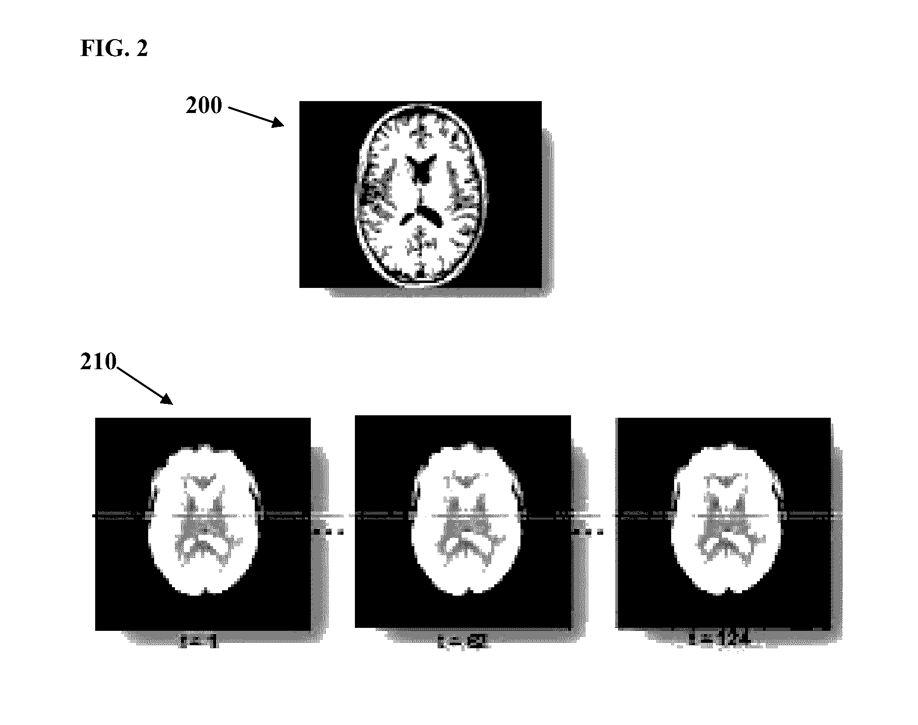 Method and system for diagnosis of attention deficit hyperactivity disorder from magnetic resonance images