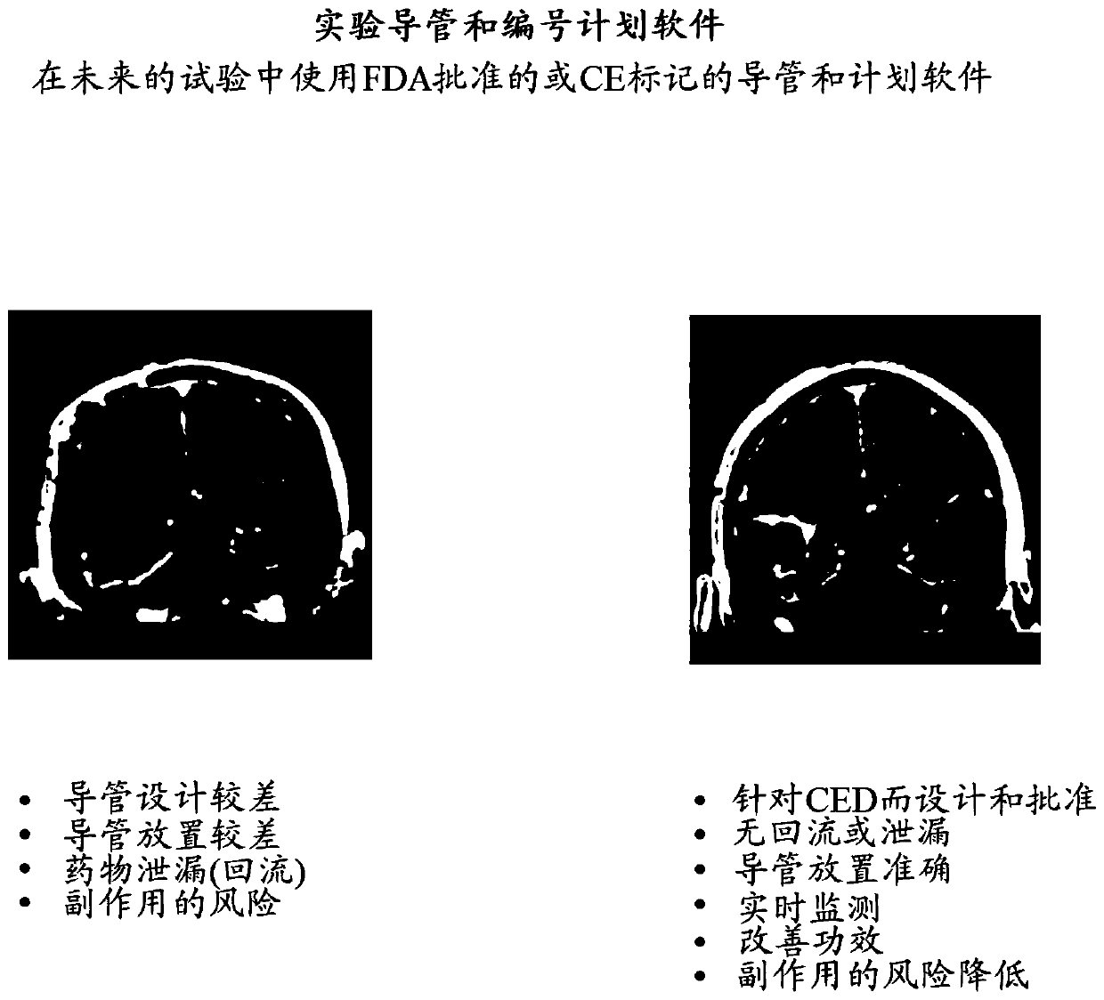 Il-4-fusion formulations for treatment of central nervous system (CNS) tumors