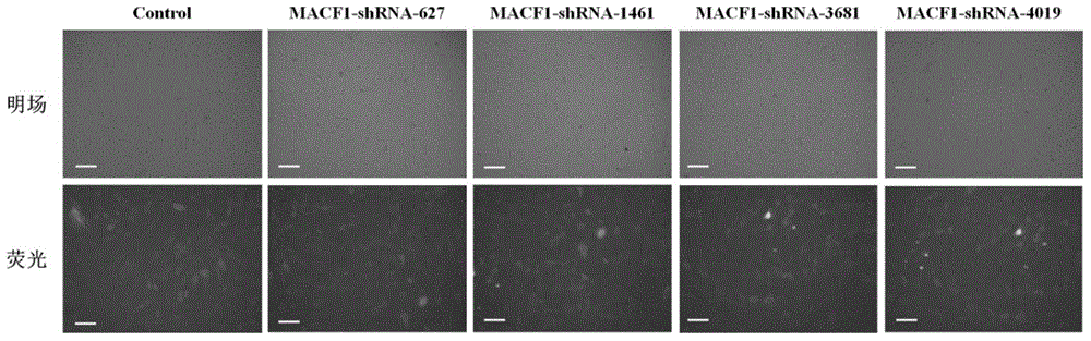 shRNA sequence for suppressing mouse MACF1 gene expression and application thereof