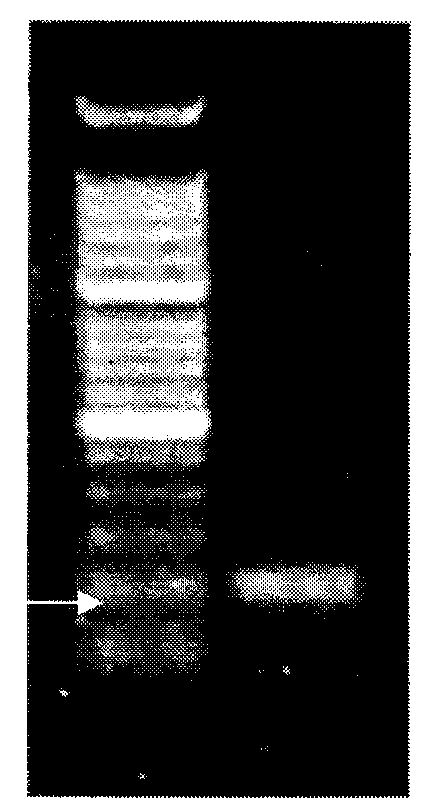 Preparation method for probes related to breast cancer molecular markers and application of same