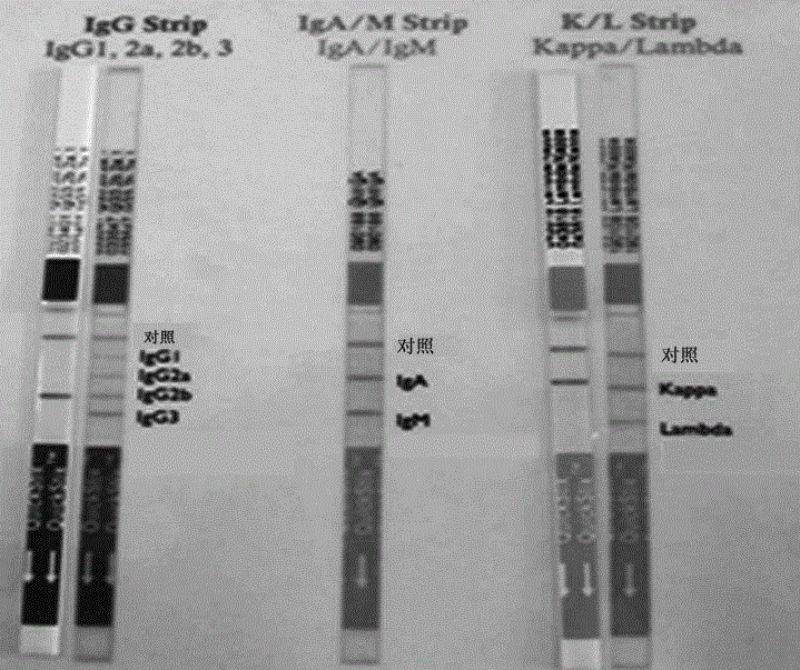 Cell strain 16, monoclonal antibody produced by cell strain 16 and use of monoclonal antibody produced by cell strain 16