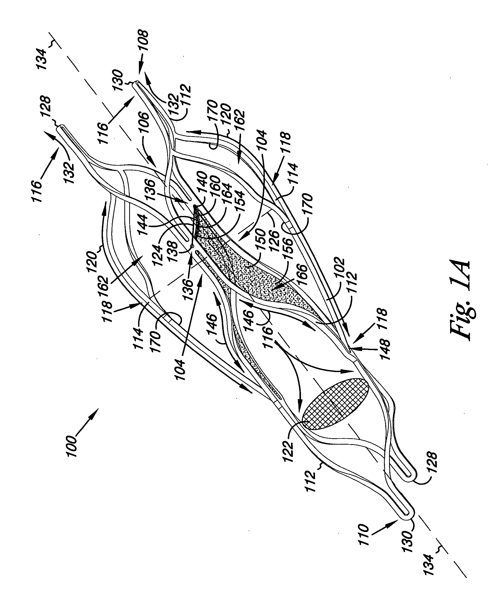 Venous valve, system, and method with sinus pocket