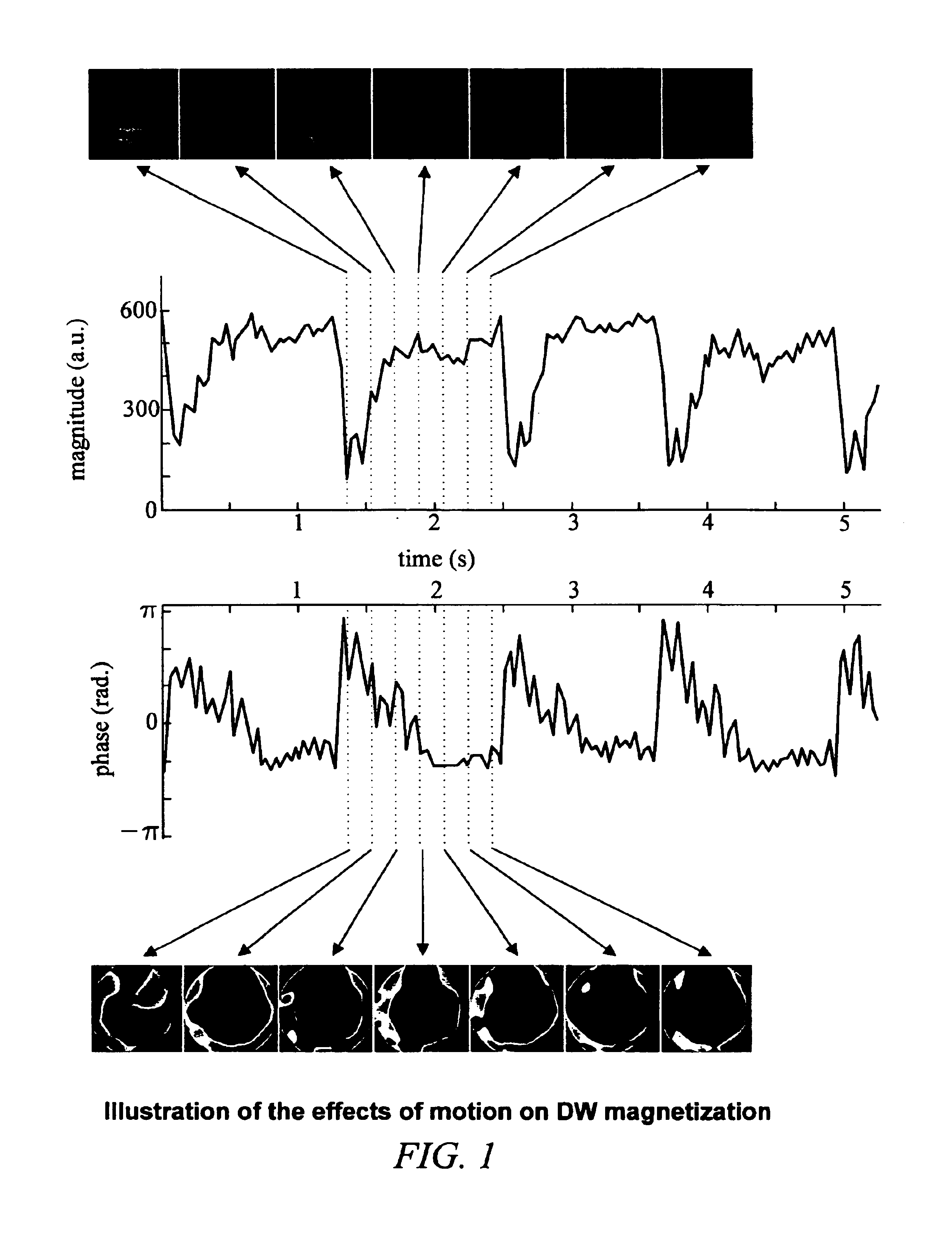 Method of removing dynamic nonlinear phase errors from MRI data