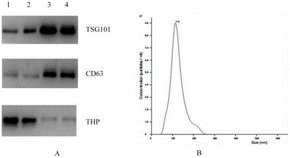 Method and reagent of extracting exosome from urine