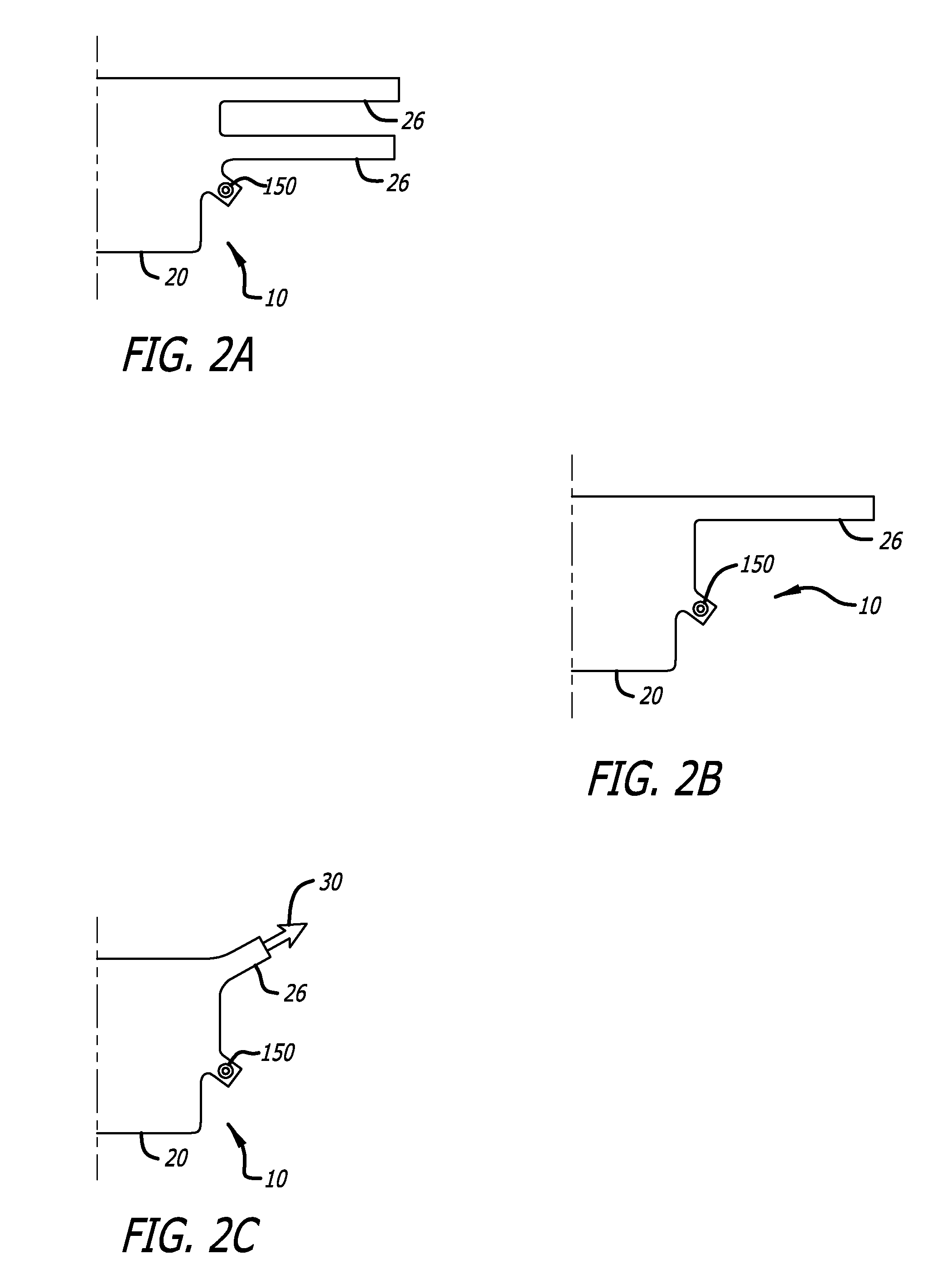 Implants And Procedures For Supporting Anatomical Structures