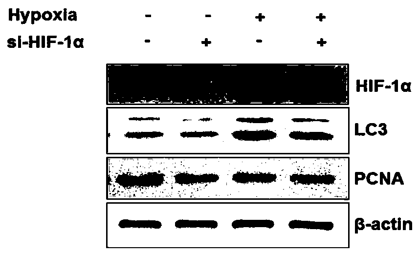 Application of FG-4592 or salt thereof in aspect of proliferation of neural stem cells