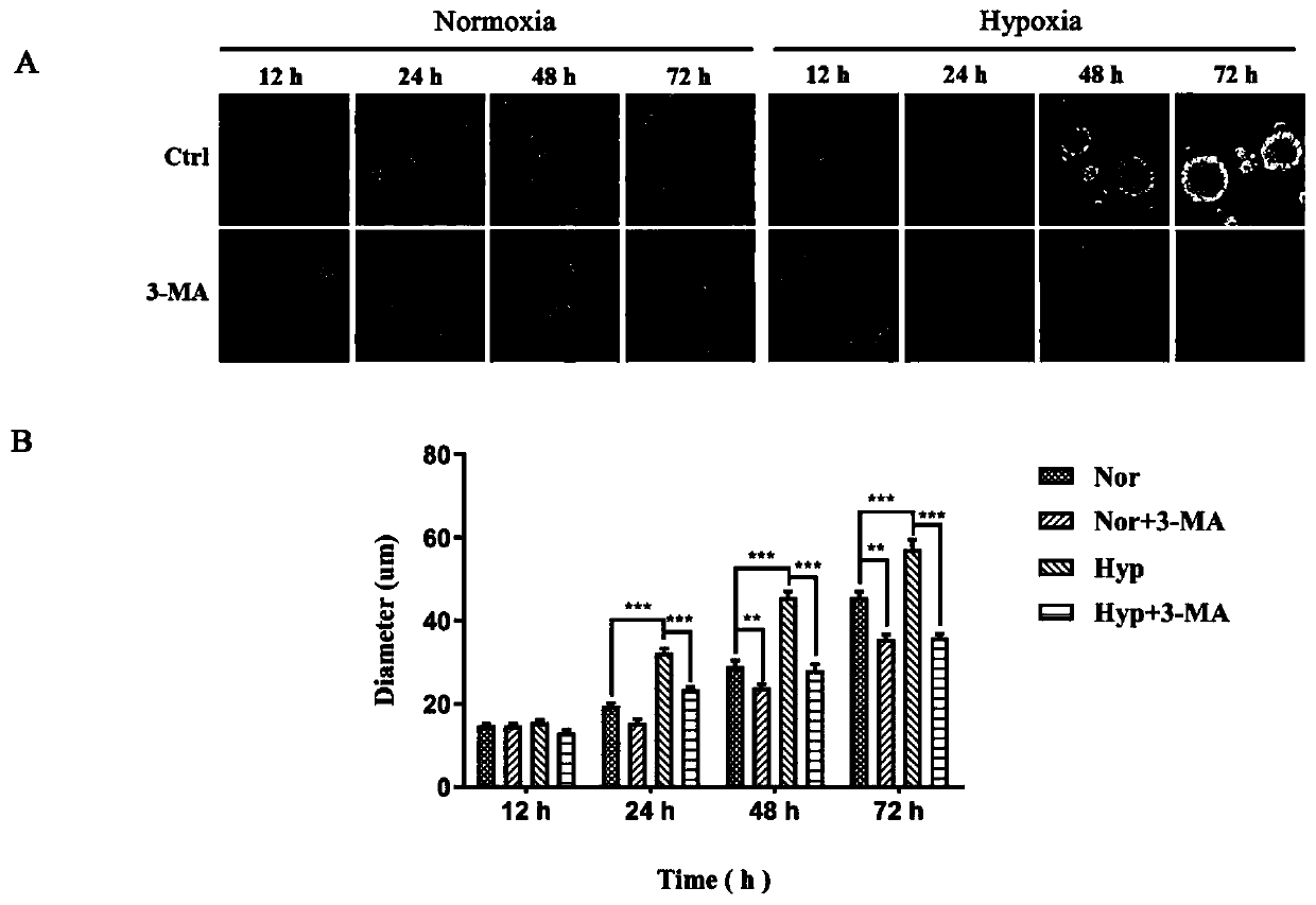 Application of FG-4592 or salt thereof in aspect of proliferation of neural stem cells