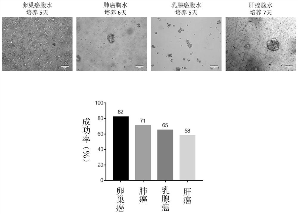 A kind of pleural and ascites organoid culture medium, culture method and drug susceptibility testing method