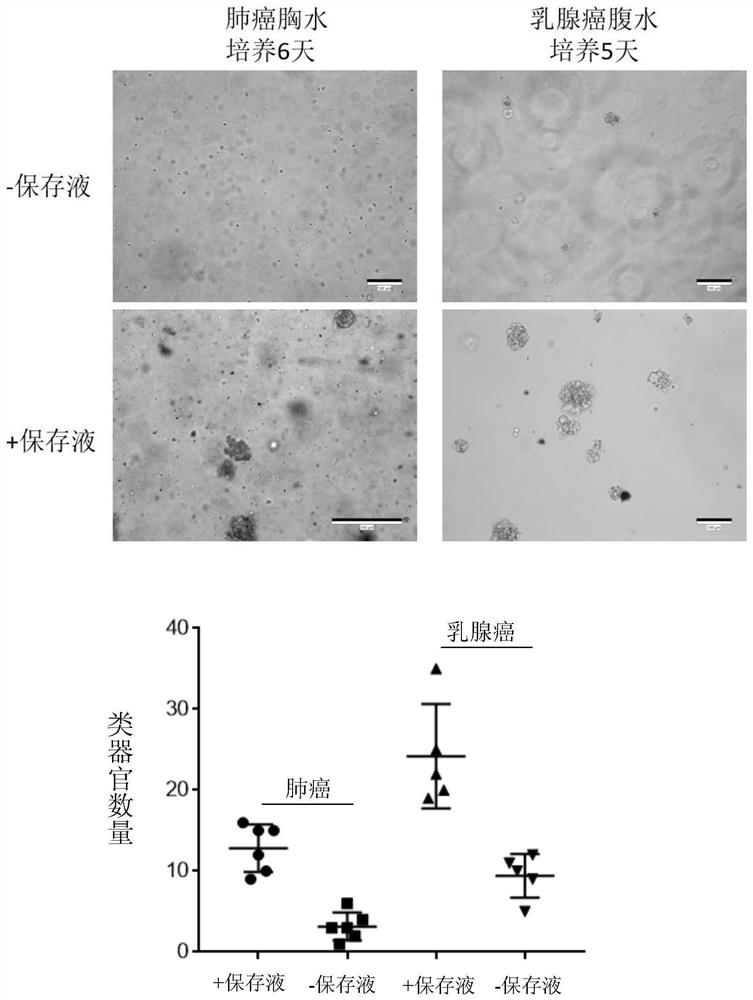 A kind of pleural and ascites organoid culture medium, culture method and drug susceptibility testing method