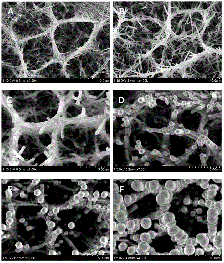 Silicon carbide (SiC)/ titanium dioxide (TiO2) composite structure biological support material and preparation method thereof
