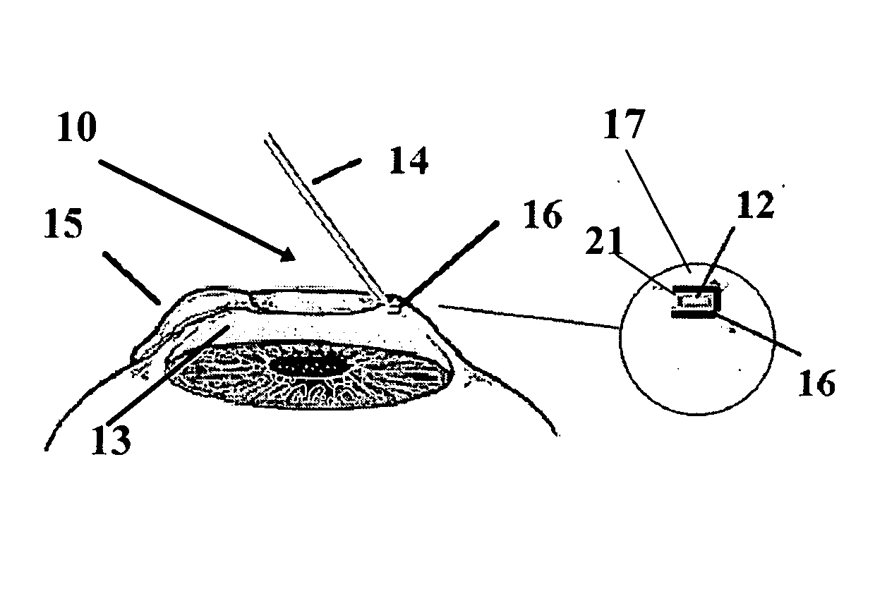 Device and method for medical records storage in the eye
