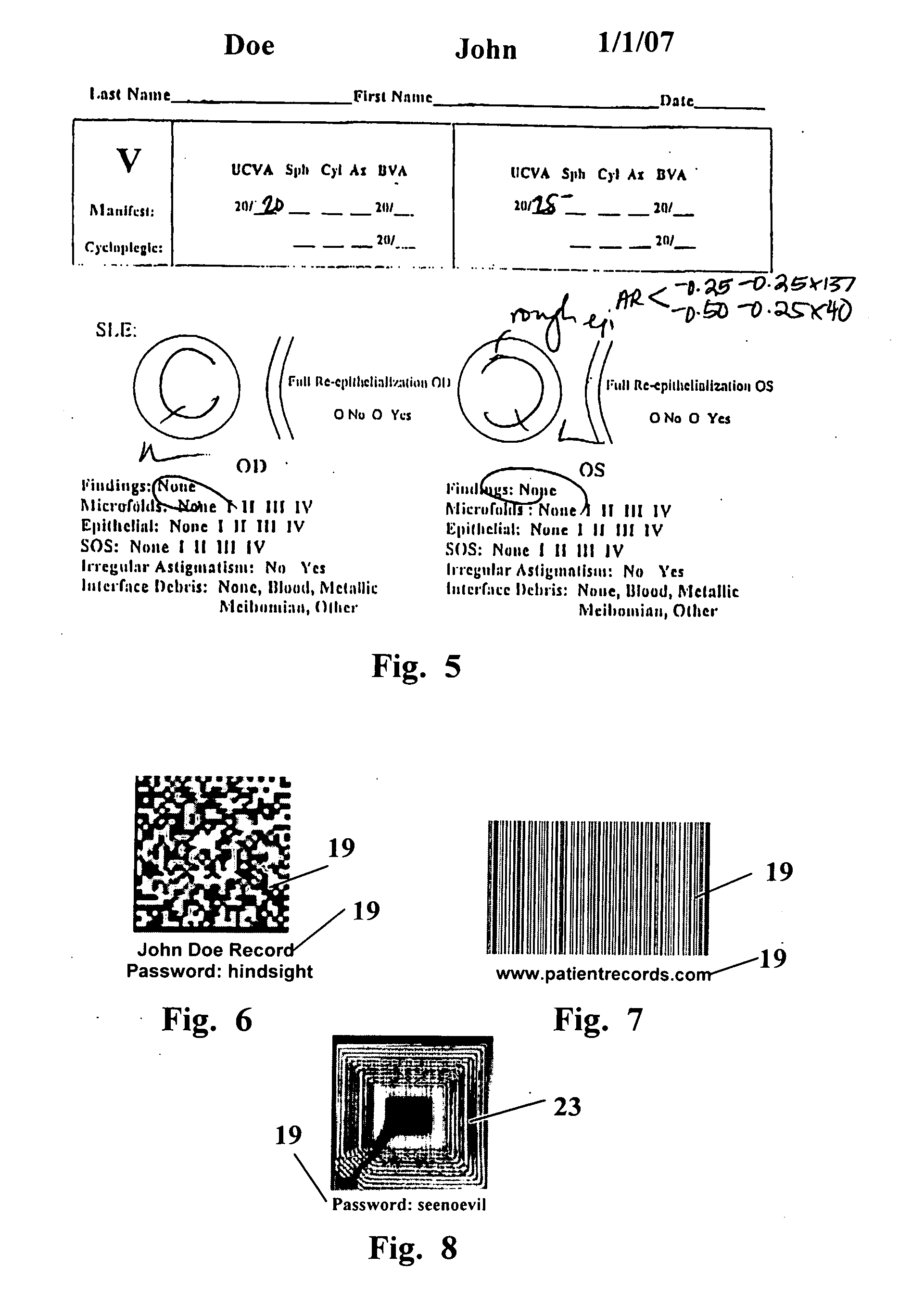 Device and method for medical records storage in the eye