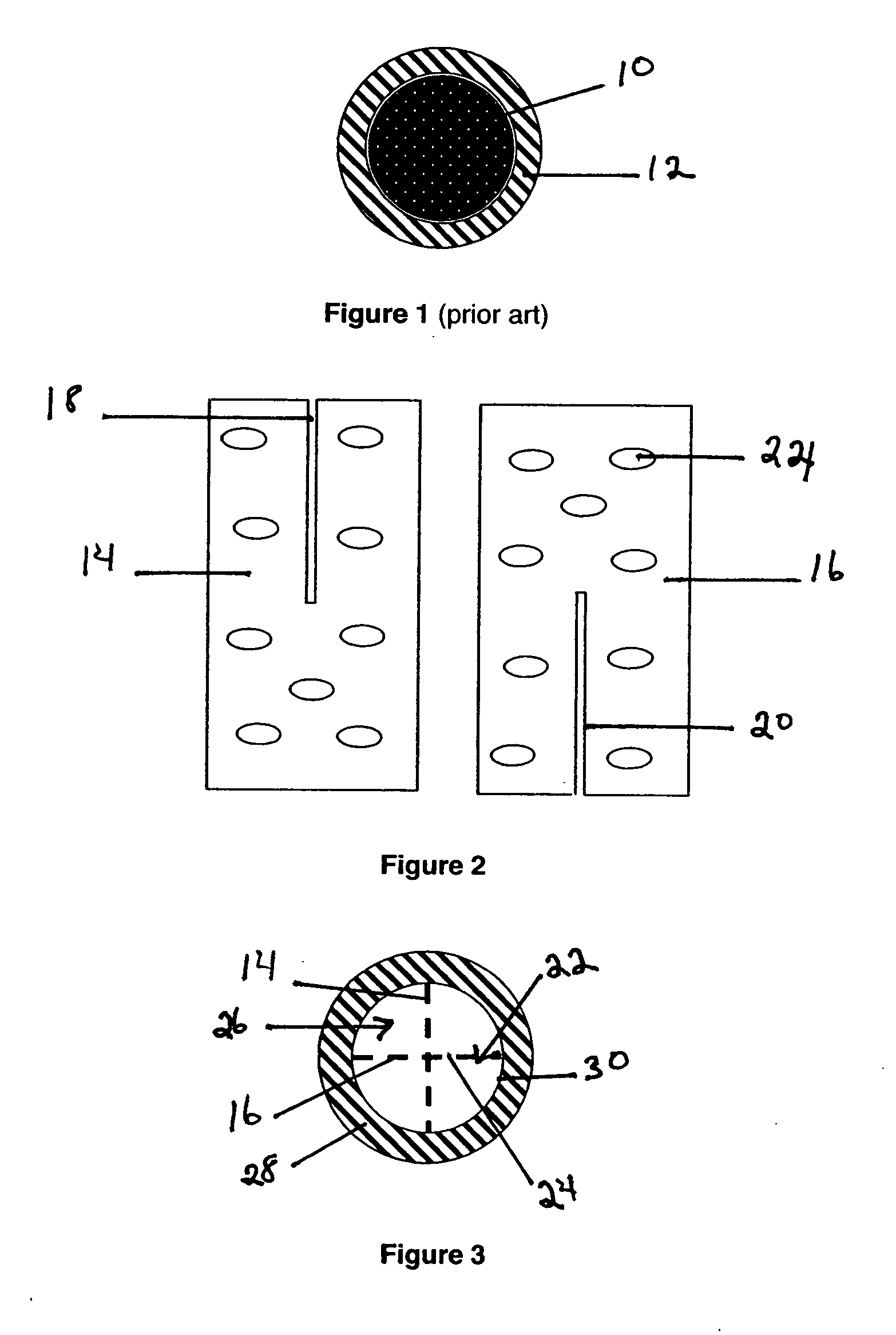 Bone implant device and methods of using same