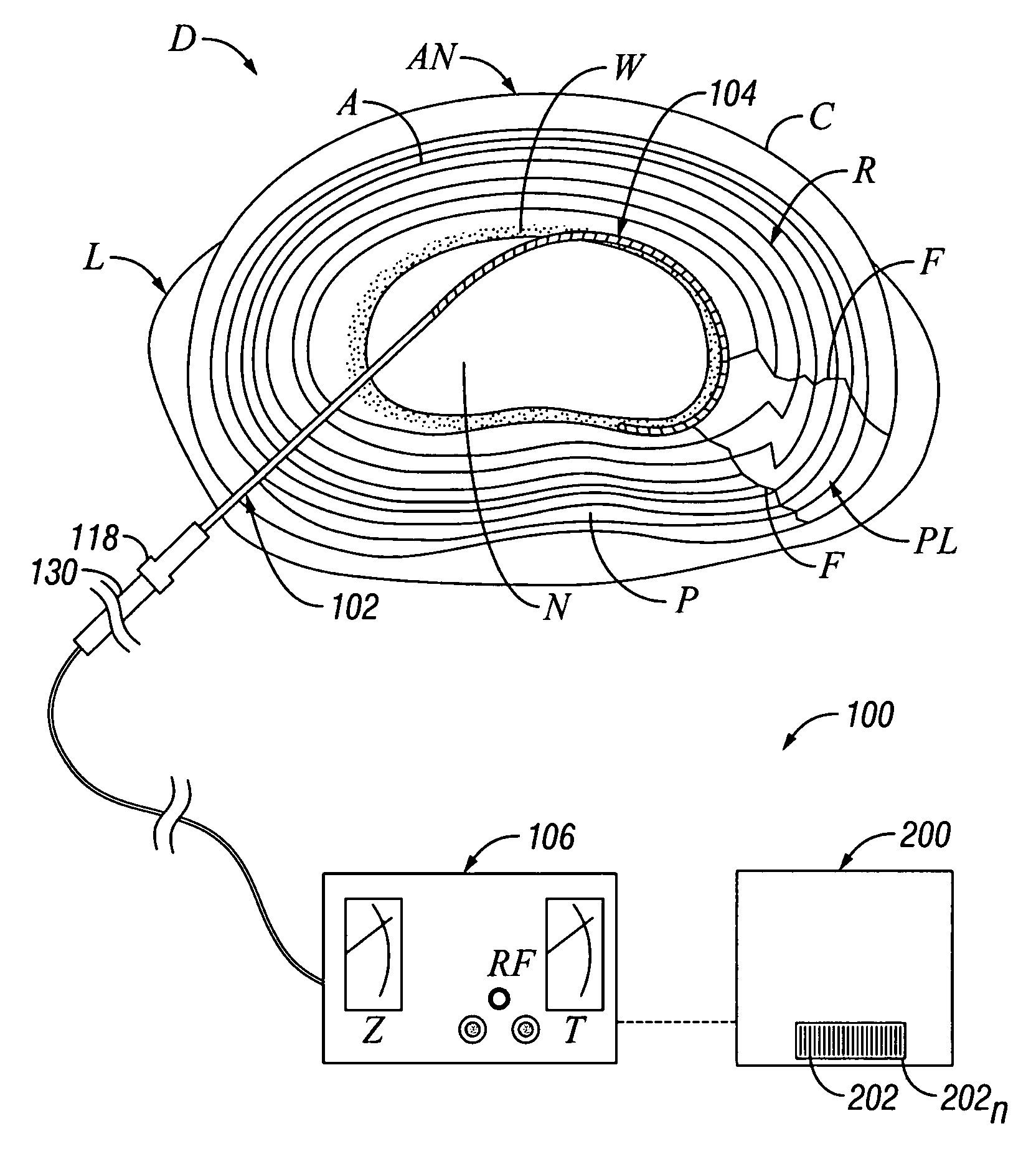 Systems and methods for thermally profiling radiofrequency electrodes
