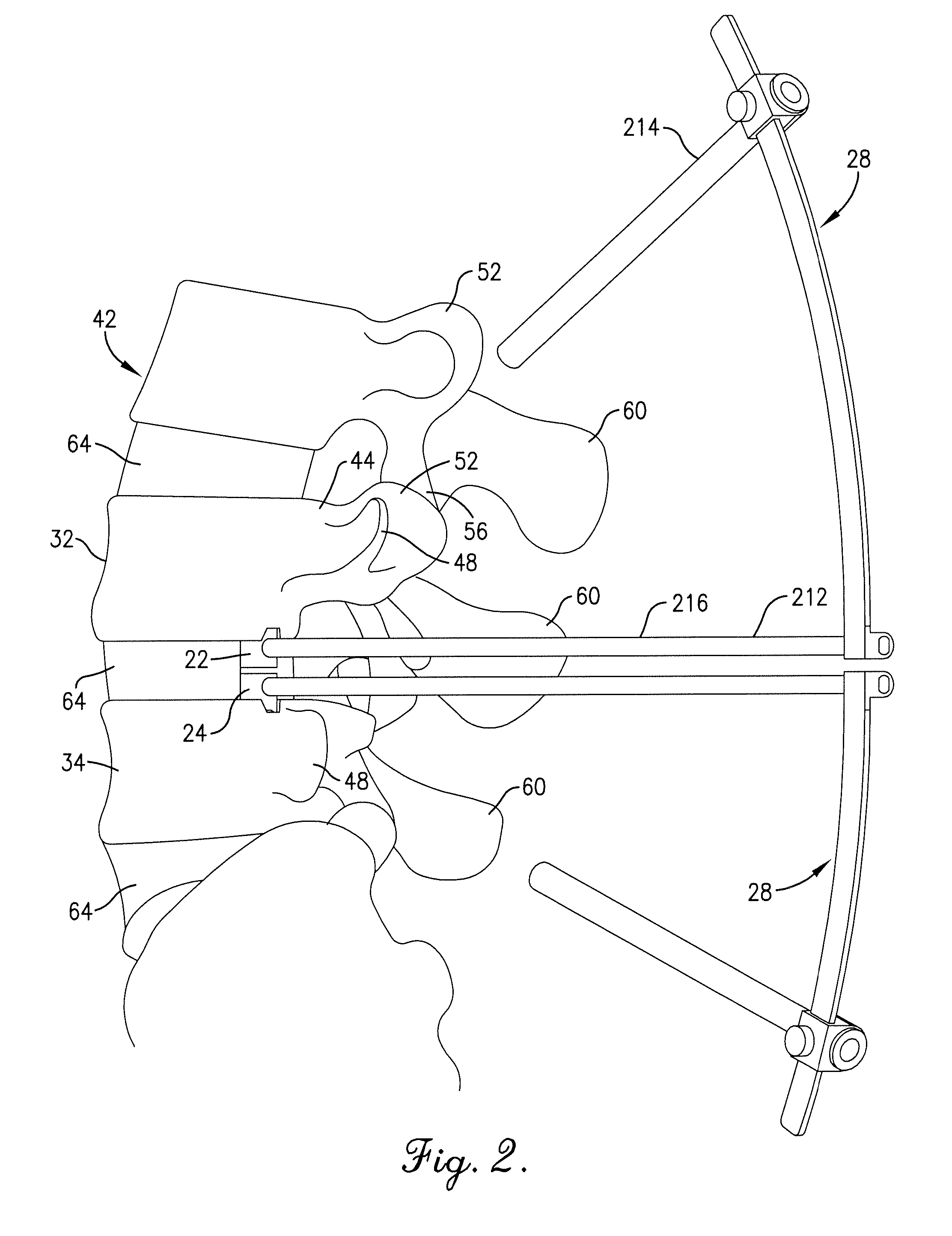Artificial spinal disc, insertion tool, and method of insertion
