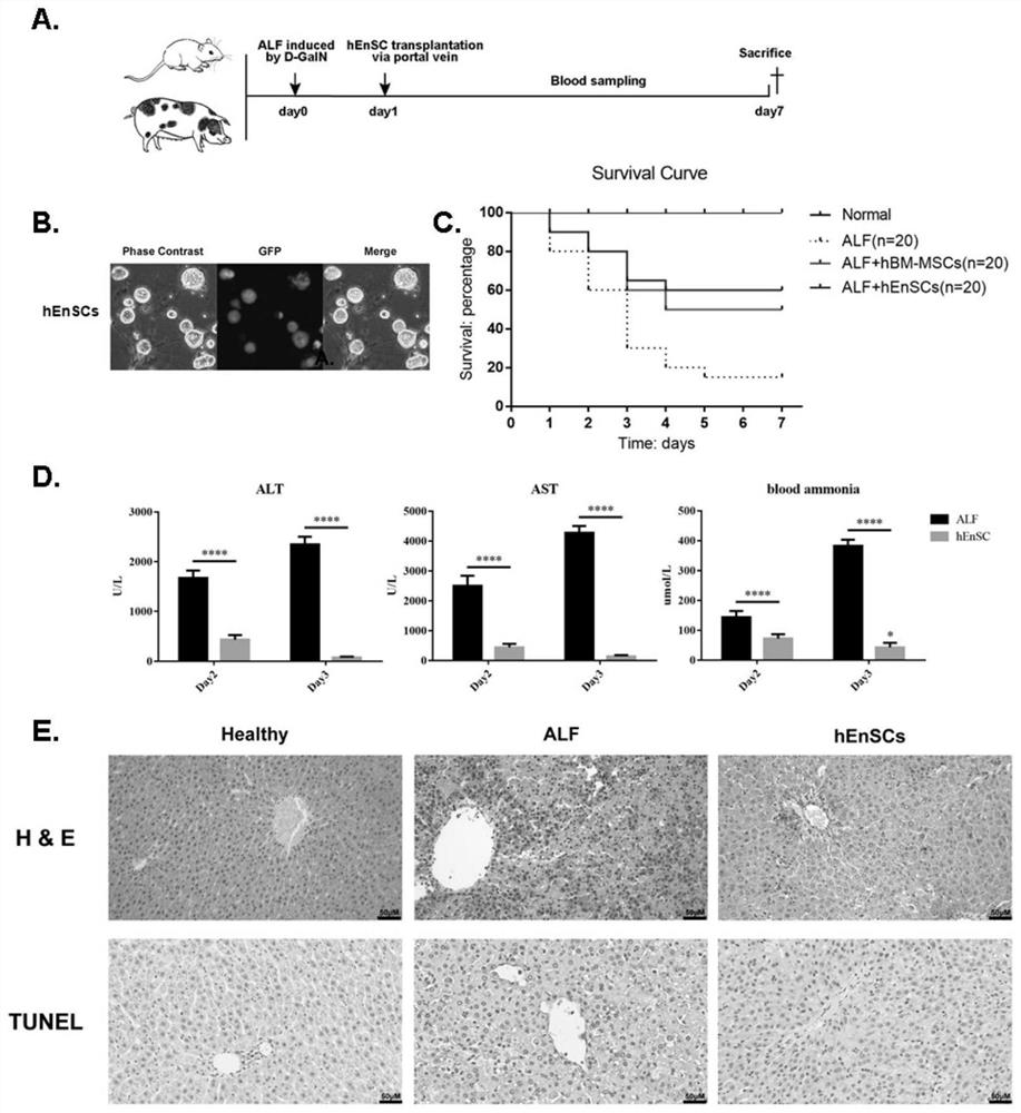 Application of entoderm stem cell in prevention and/ or treatment of liver immune disorder disease