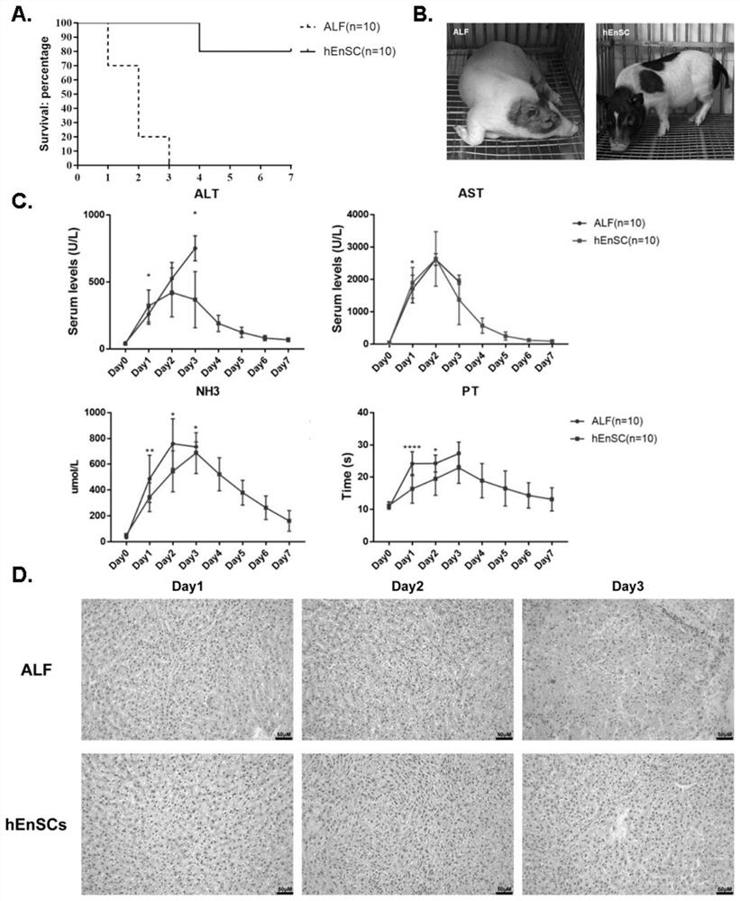 Application of entoderm stem cell in prevention and/ or treatment of liver immune disorder disease