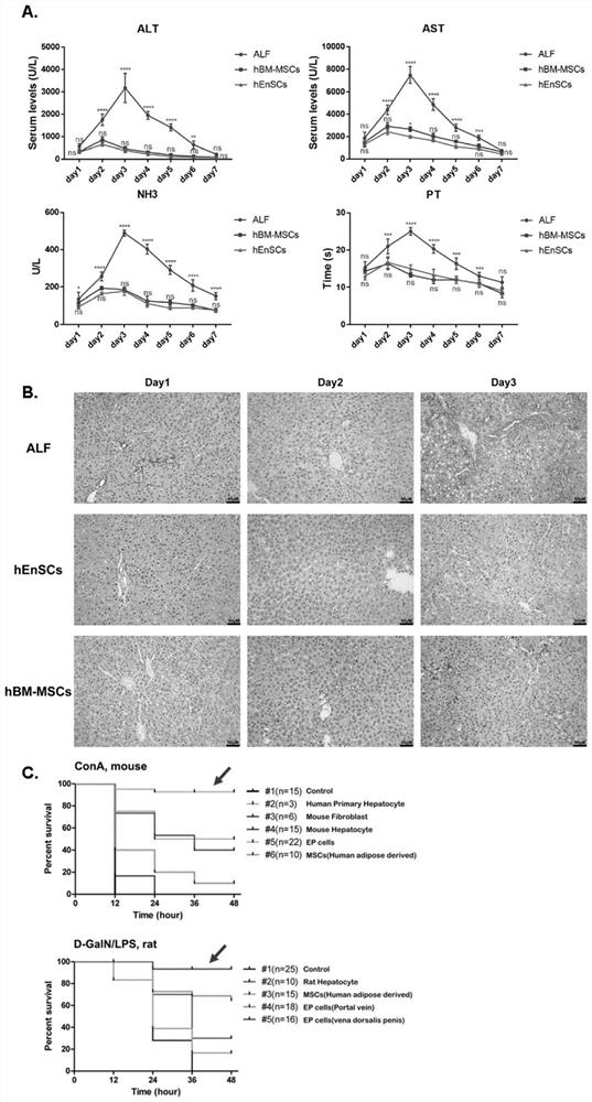 Application of entoderm stem cell in prevention and/ or treatment of liver immune disorder disease