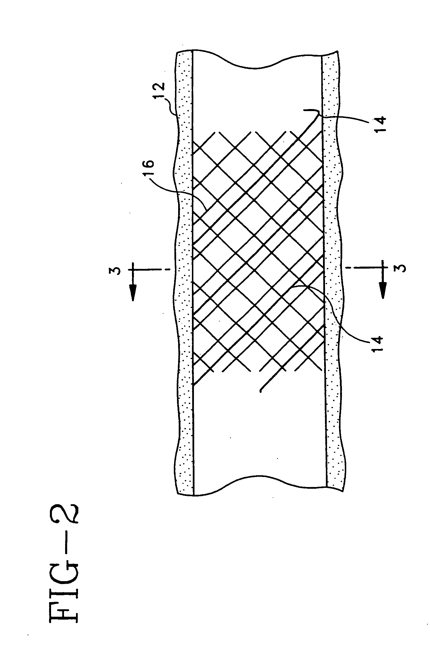 Bioabsorbable marker having radiopaque constituents and method of using the same