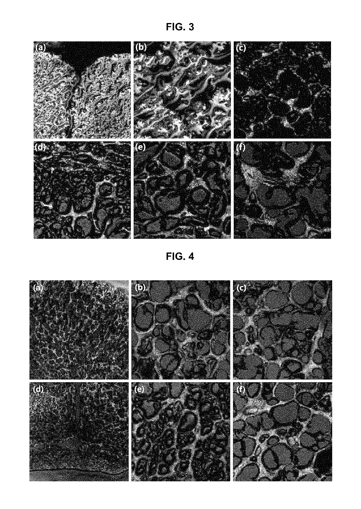 Composition for preventing, ameliorating, or treating neurological disease containing osmotin peptide as active ingredient