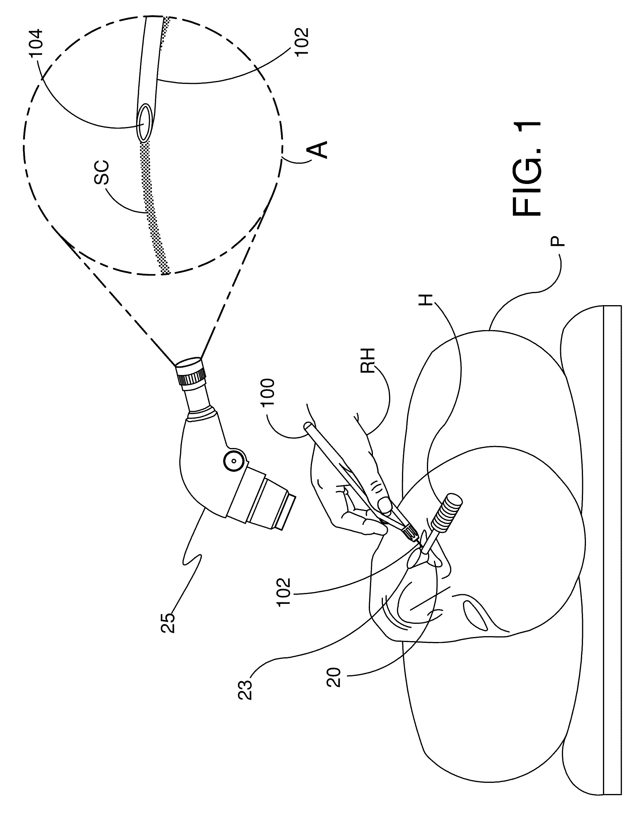 Ocular implants and methods for delivering ocular implants into the eye