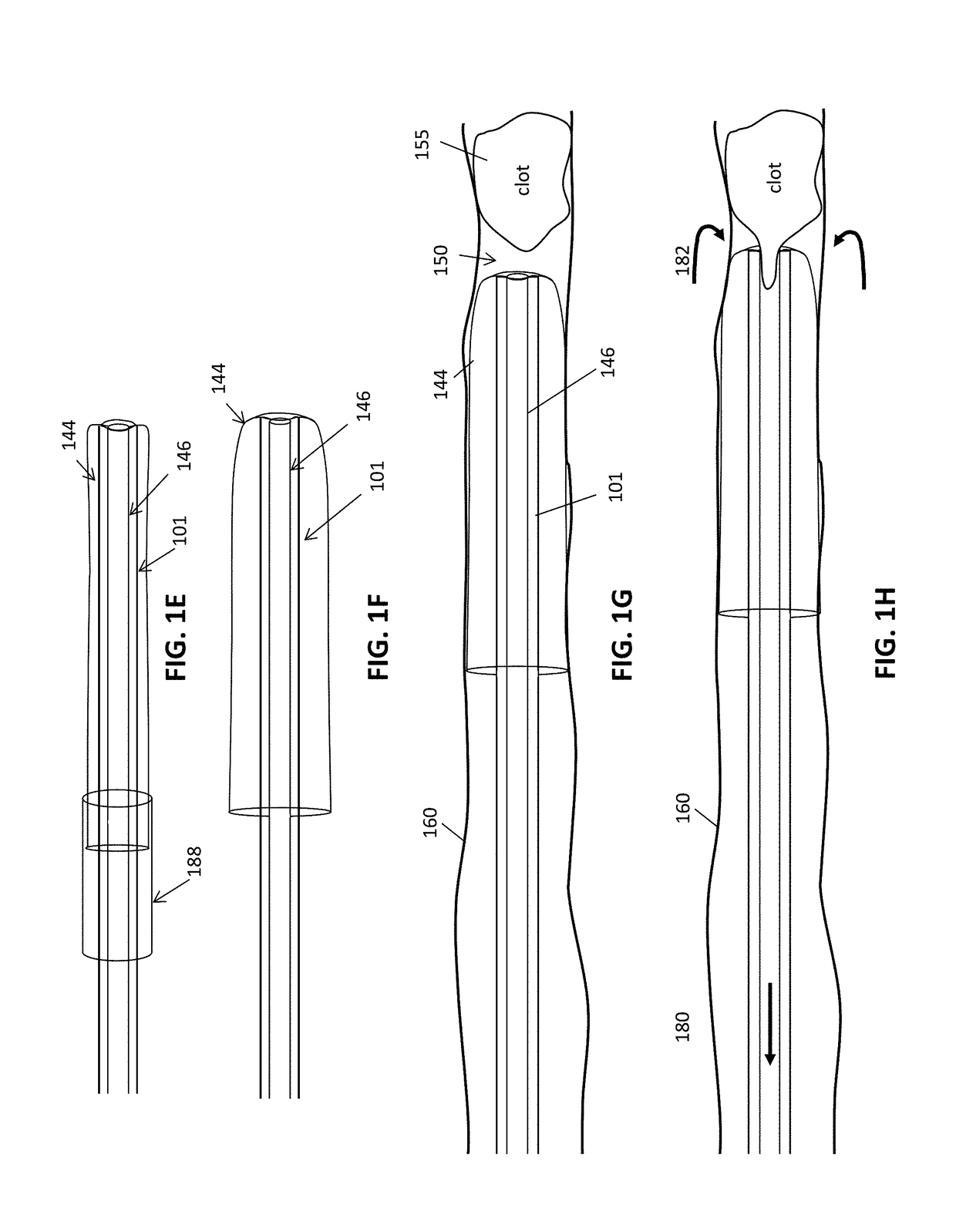 Anti-jamming and macerating thrombectomy apparatuses and methods