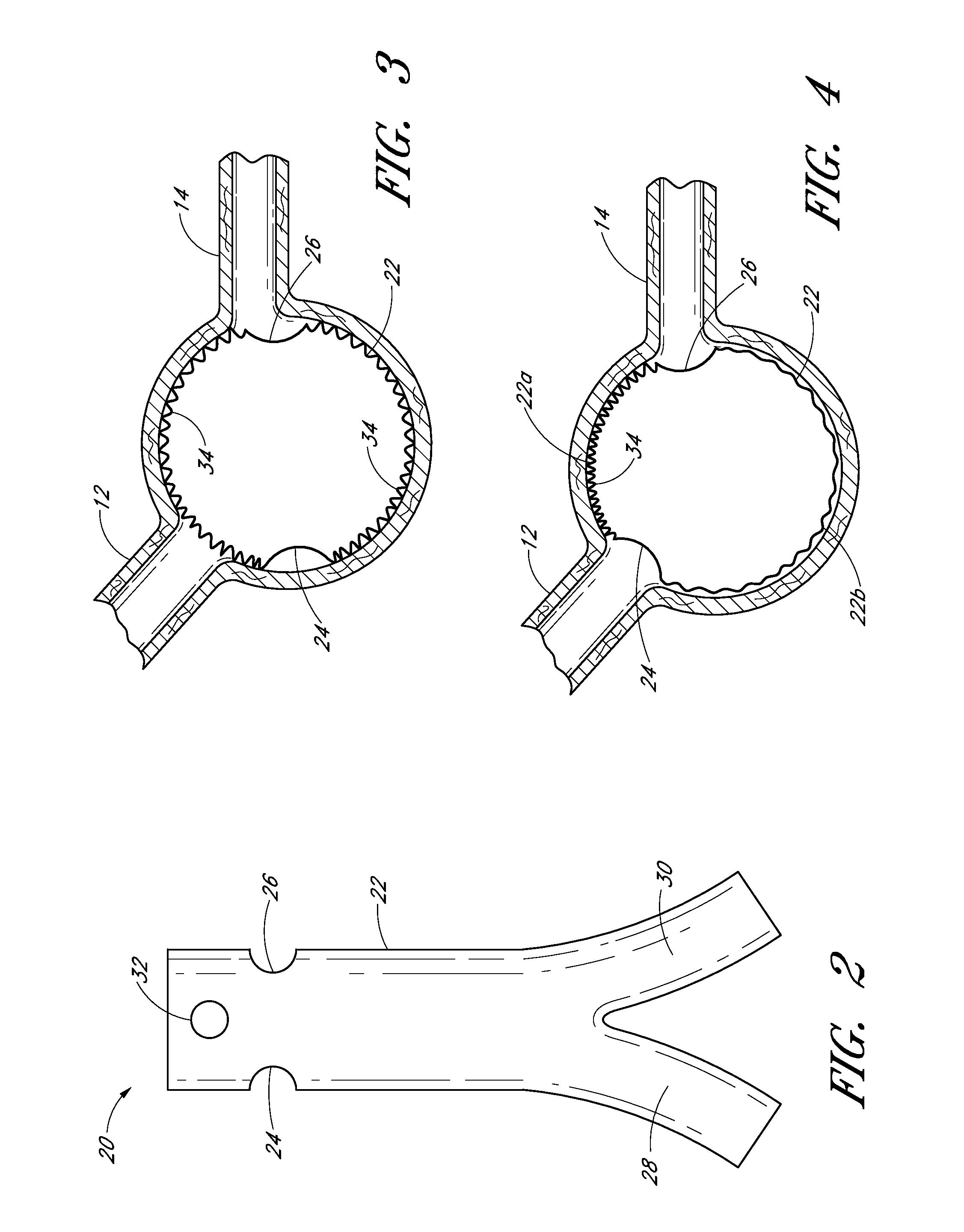 Apparatus and method of placement of a graft or graft system