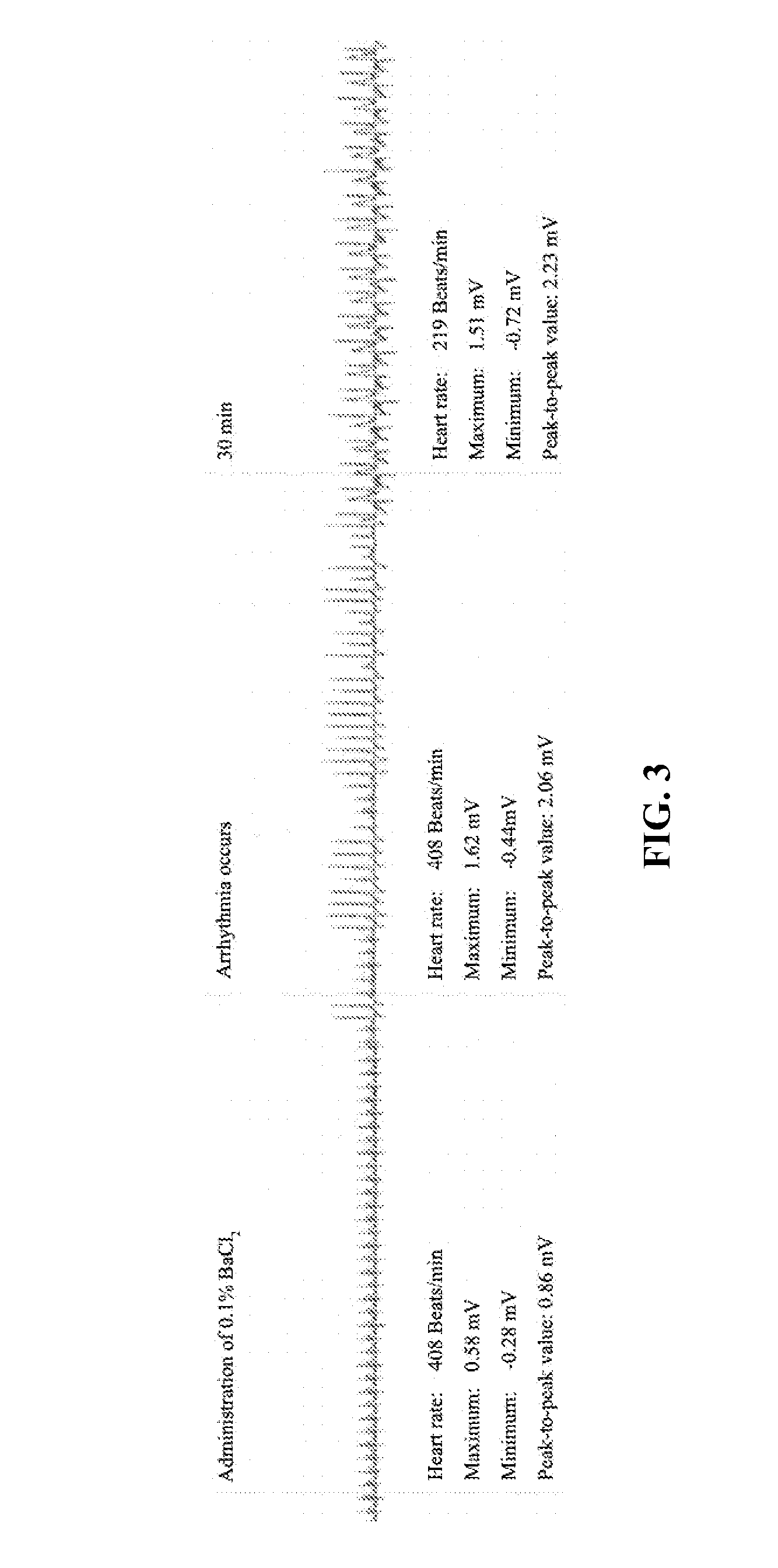 7,2''-dehydrate puerarin and its salts, preparation method and use thereof