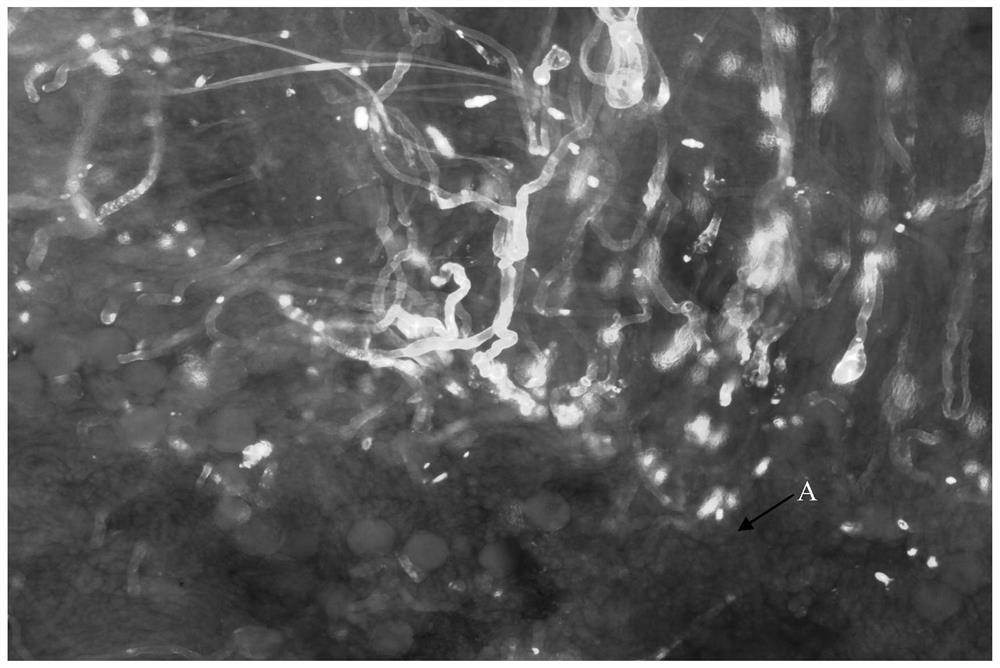 An Efficient and High-Definition Fluorescence Microscopy Method for Observing the Growth of Plant Pollen Tubes in the Pistil