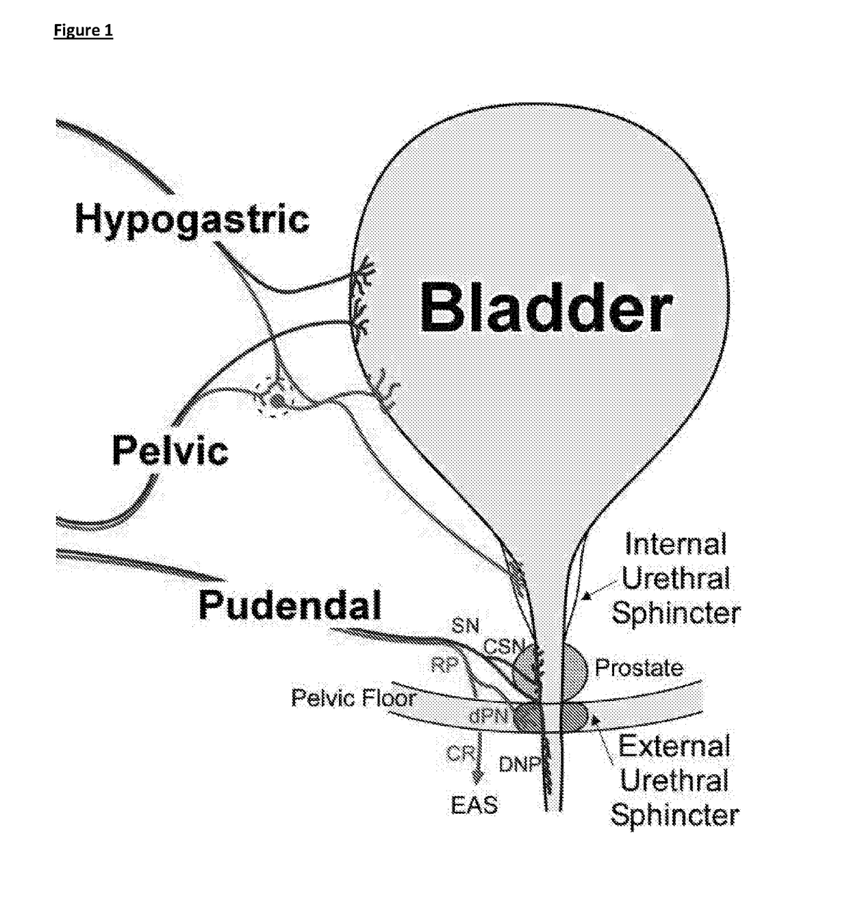 State-dependent peripheral neuromodulation to treat bladder dysfunction
